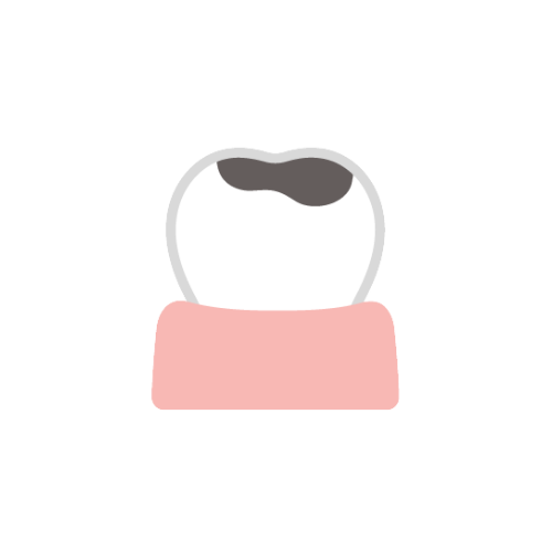 アイコン：むし歯治療